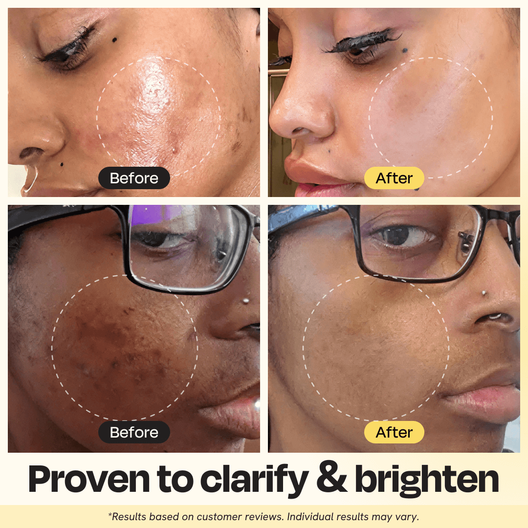 Natural vitamin C clay face mask for glowing skin
